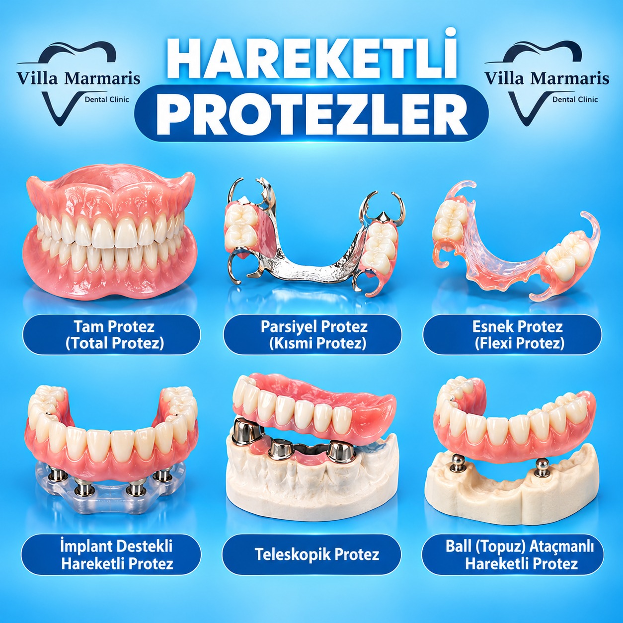 Hareketli protez çeşitleri