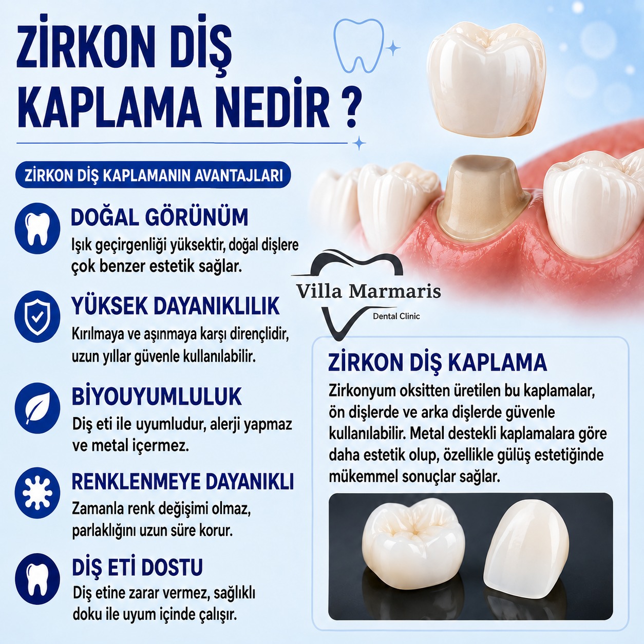 Zirkon diş kaplama