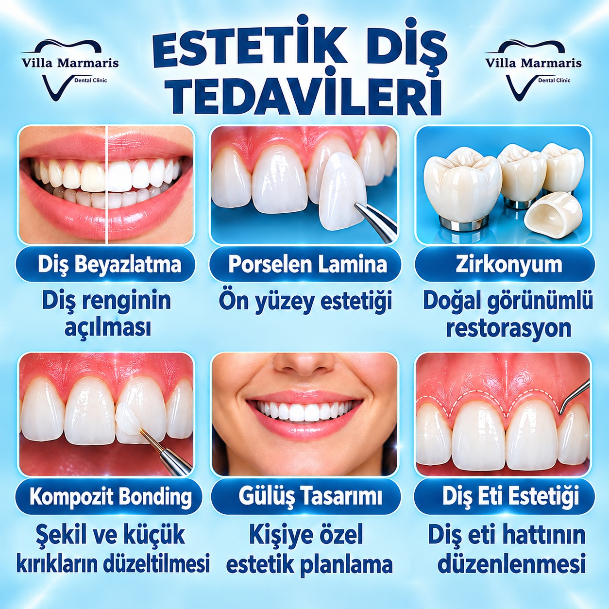 Estetik diş tedavileri seçenekleri