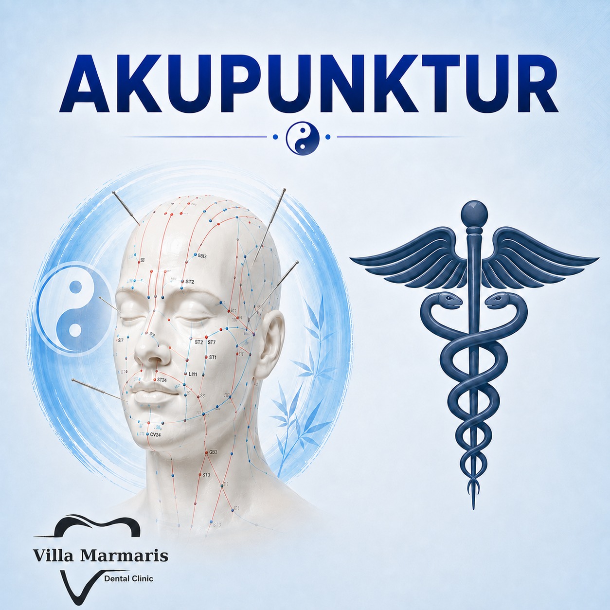 Akupunktur