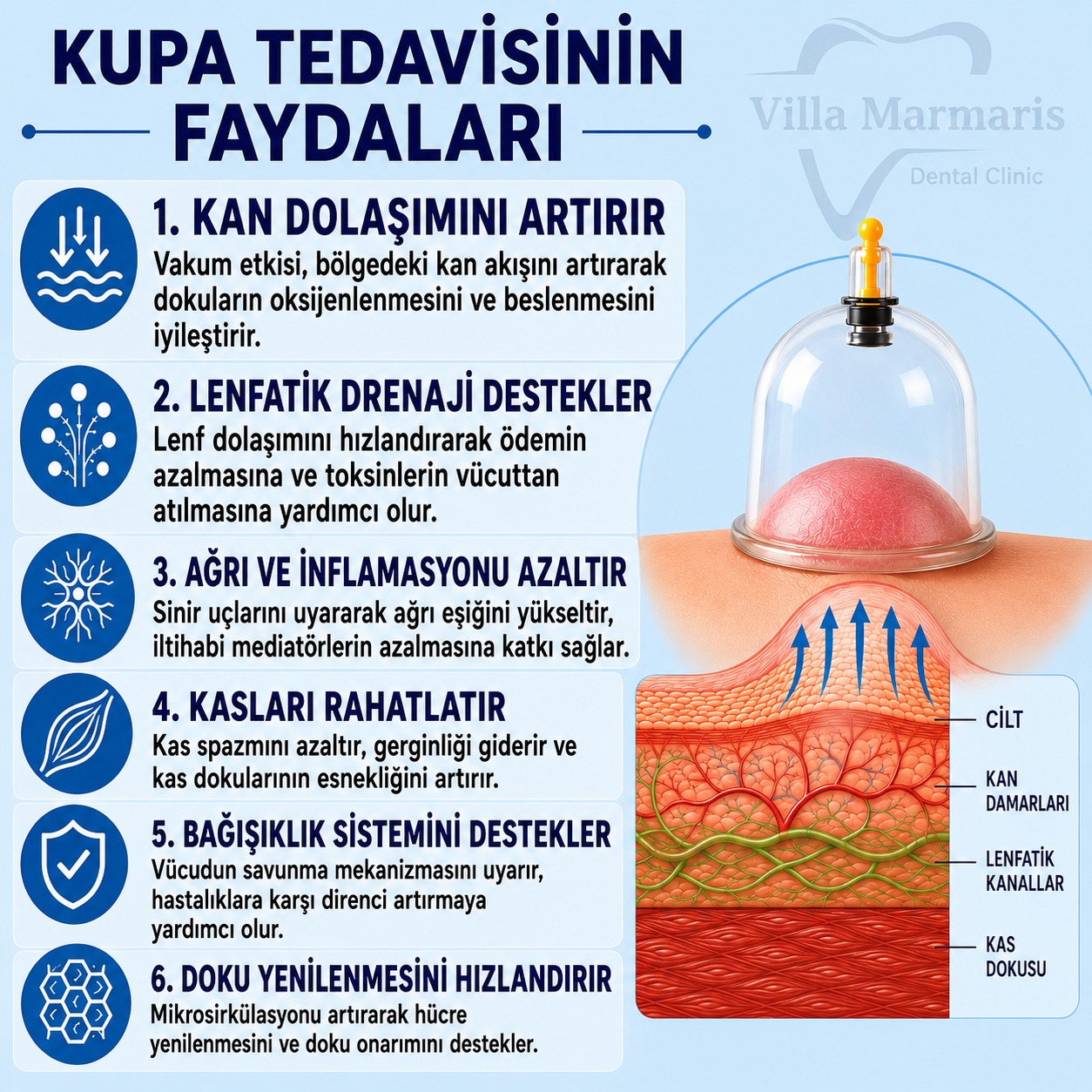 Kupa tedavisinin faydaları
