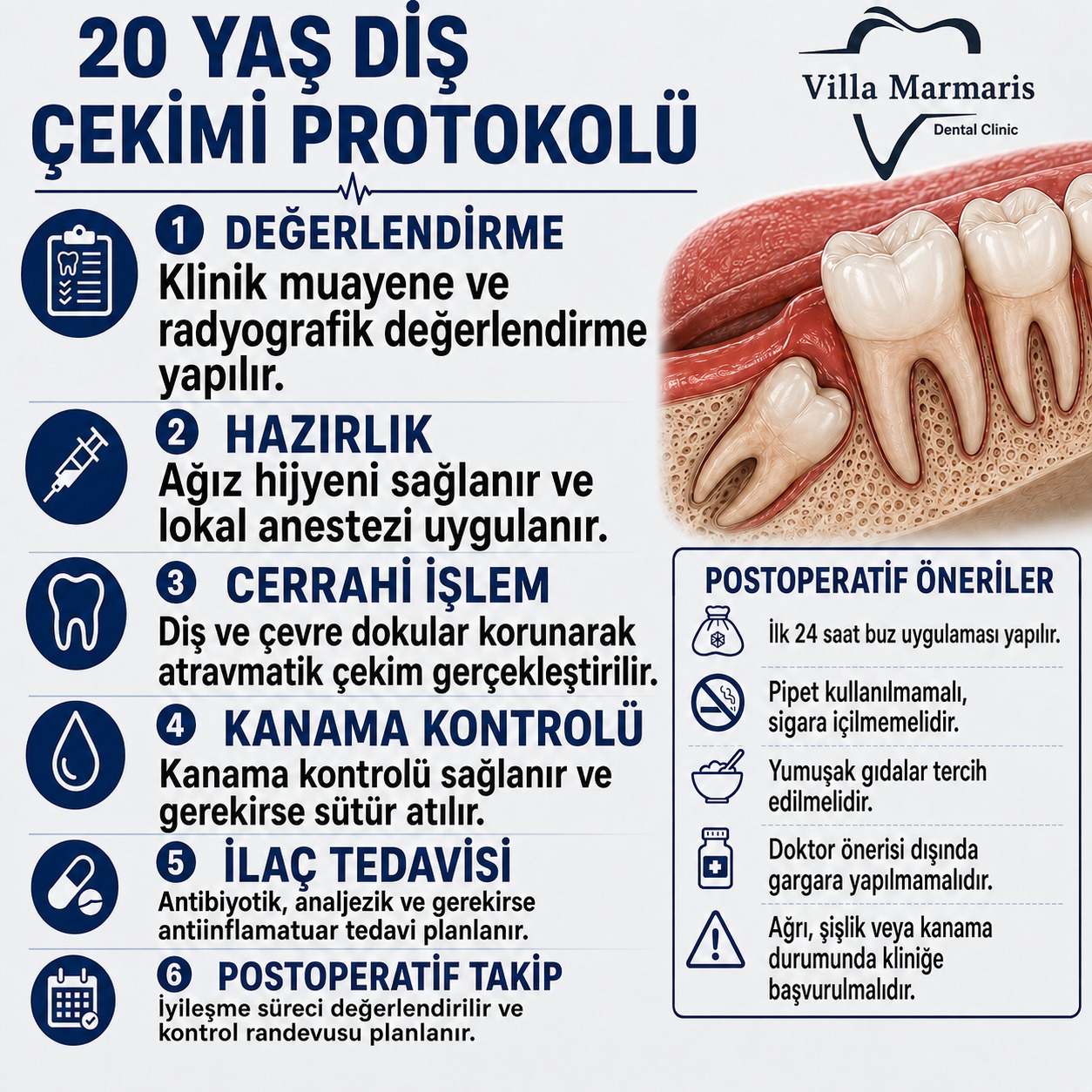 20 yaş dişi çekimi protokolü
